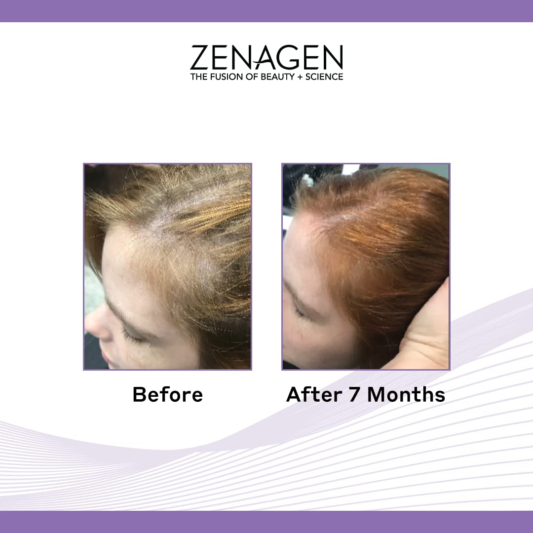 Zenagen Revolve Thickening and Hair Loss Shampoo Treatment for Women, 16-oz Organic Plant Based - Reverse Generation