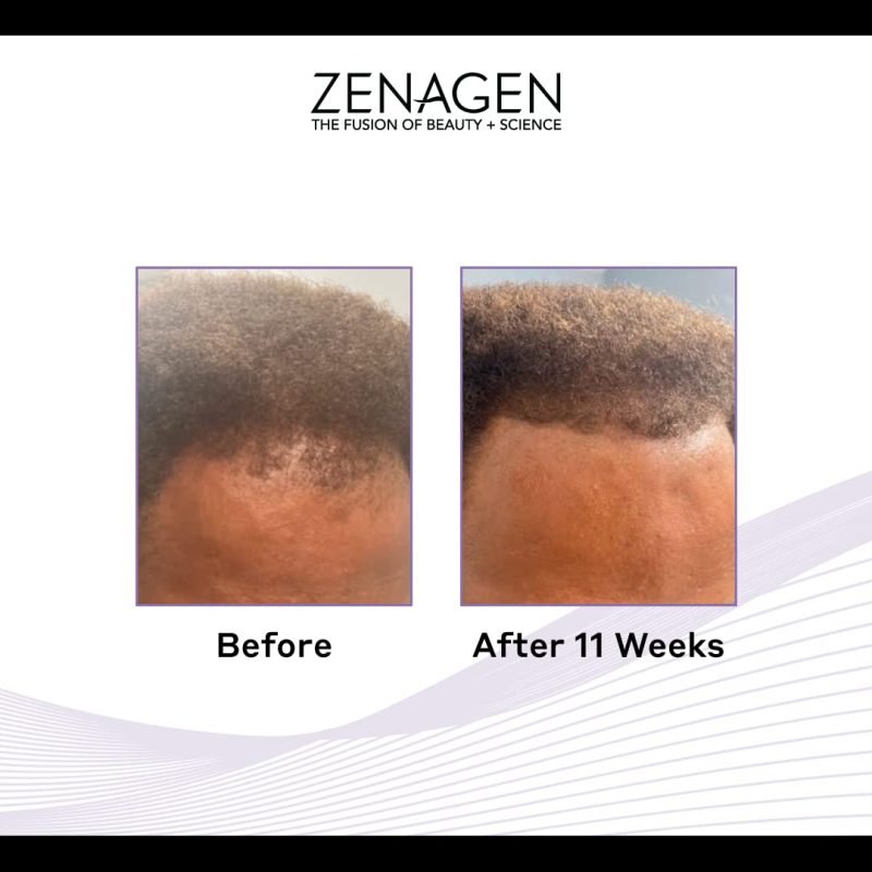 Zenagen Revolve Shampoo for Men, 16-oz Hair loss Treatment for men Organic Plant Based - Reverse Generation