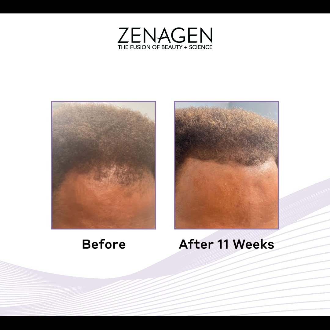 Zenagen Revolve Shampoo for Men, 16-oz Hair loss Treatment for men Organic Plant Based - Reverse Generation