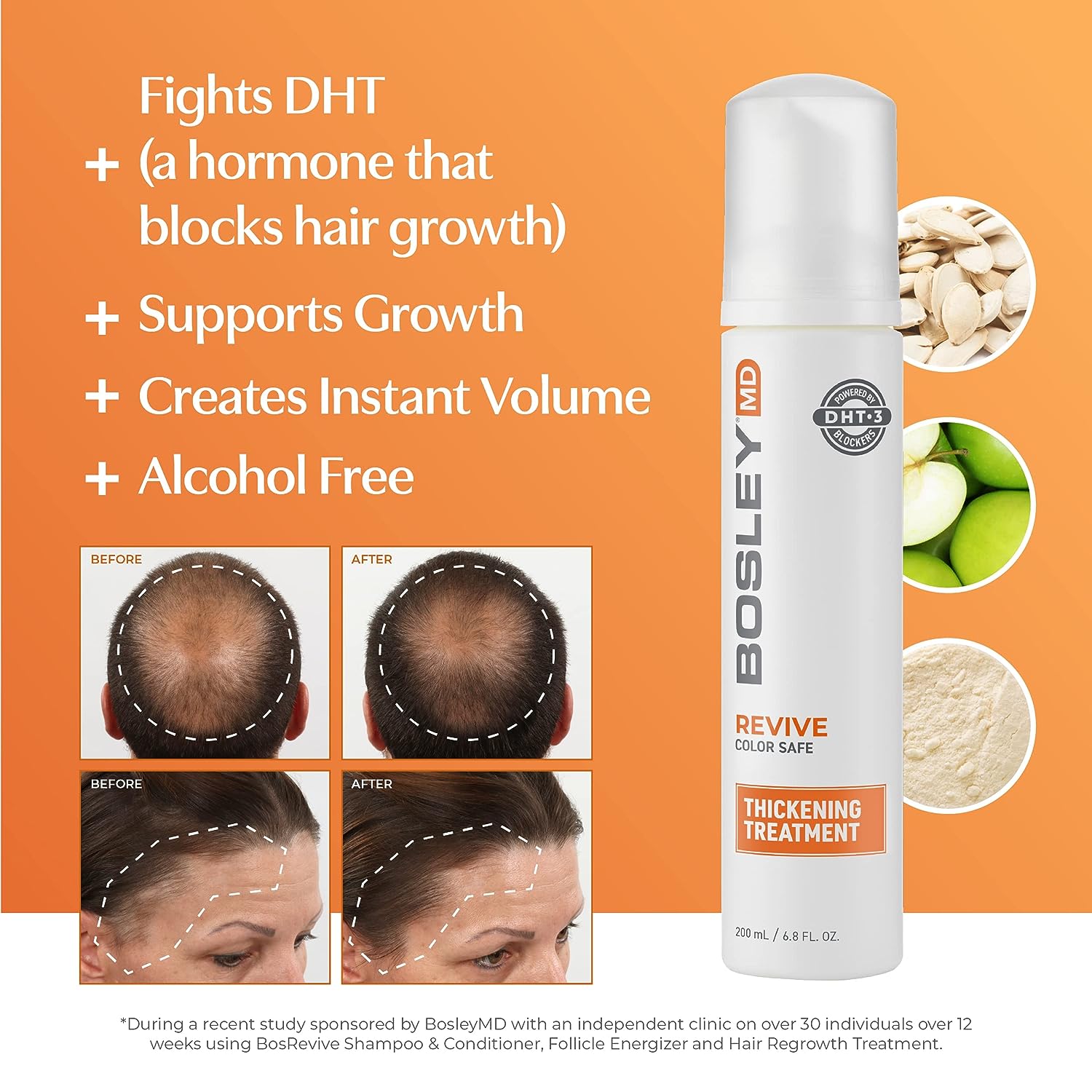 Bosley Non Colored Thickening Treatment, 6.8 - oz - Reverse Generation Established in 2008