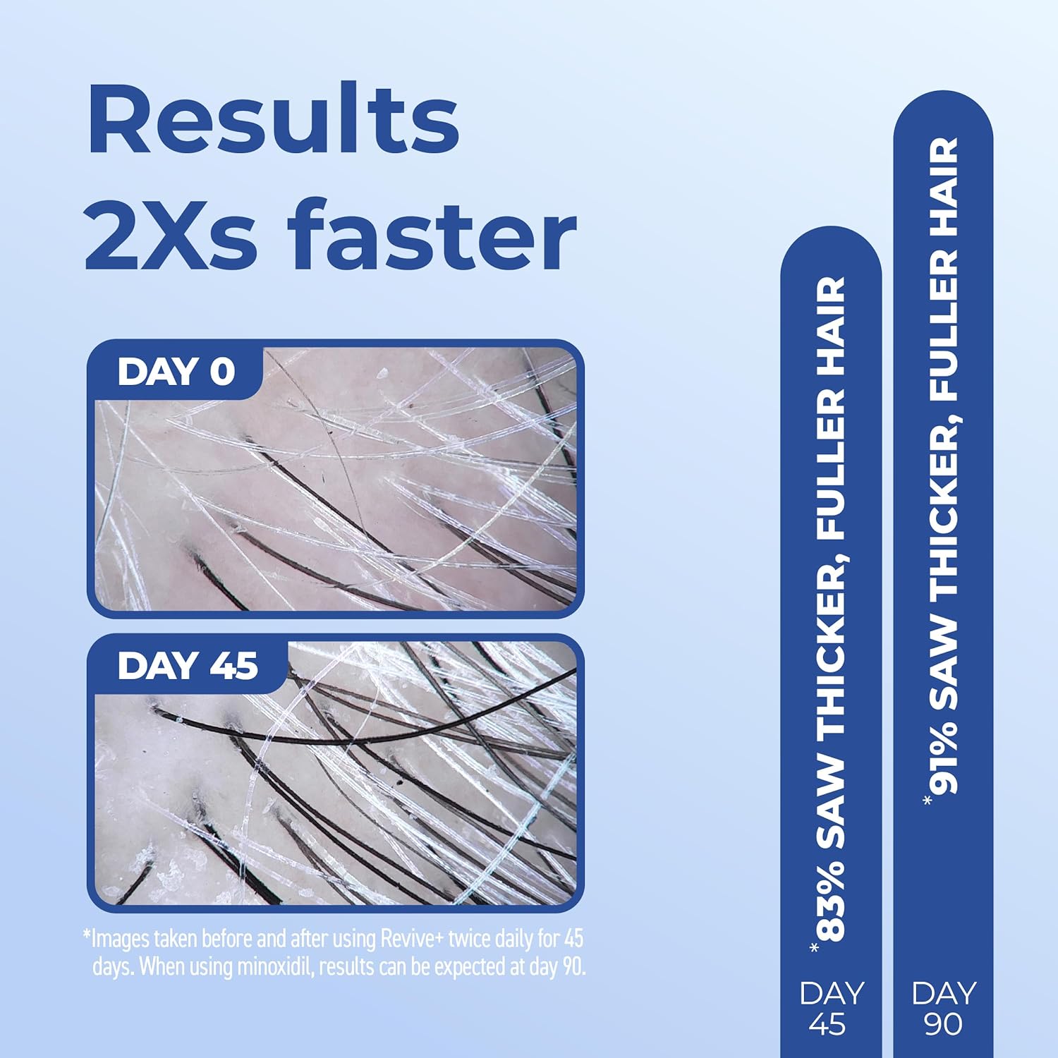 Bosley Revive Densify Foam For Men 83% INCREASE IN DENSITY - Reverse Generation
