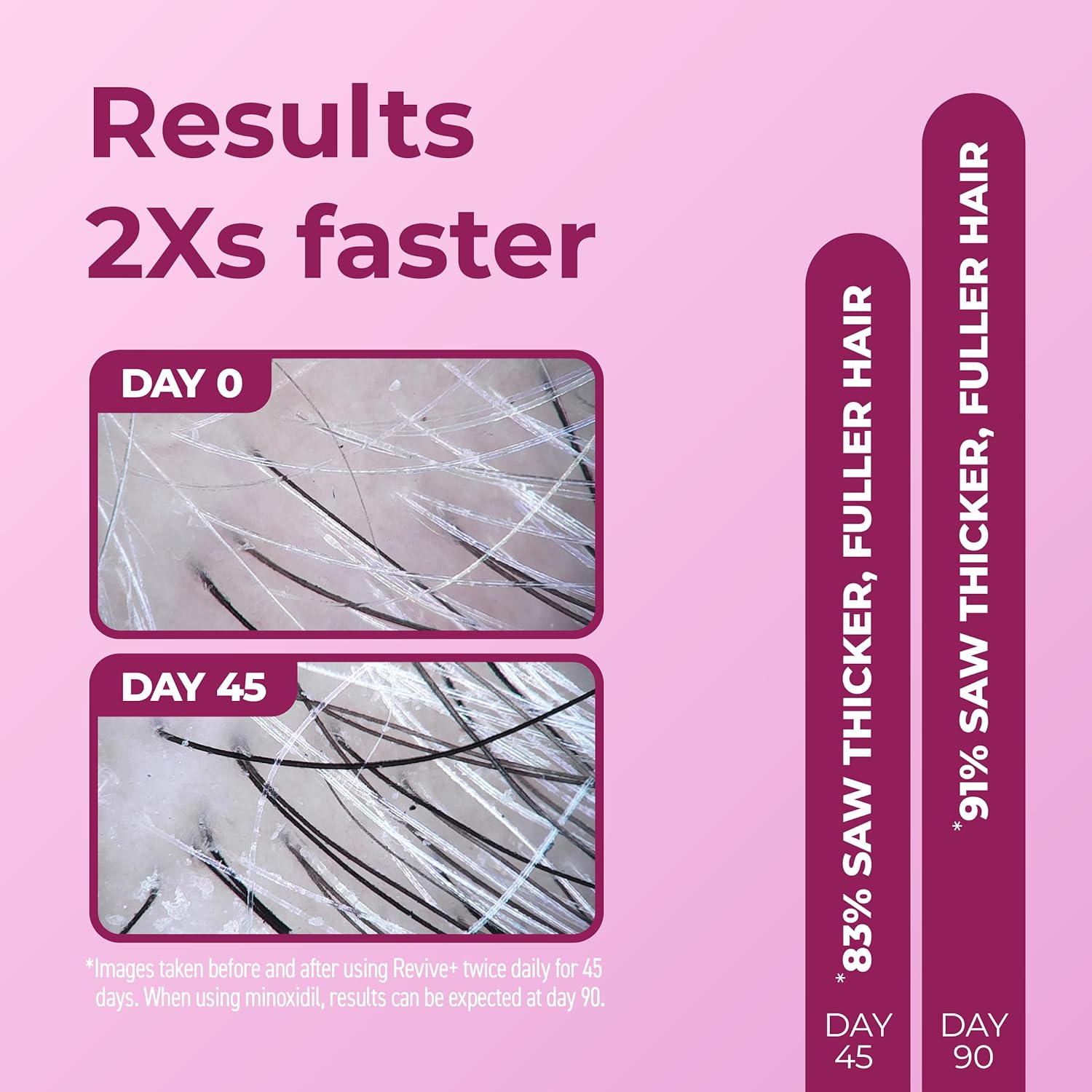 Bosley Revive Densifying Foam for Women 83% INCREASE IN DENSITY - Reverse Generation