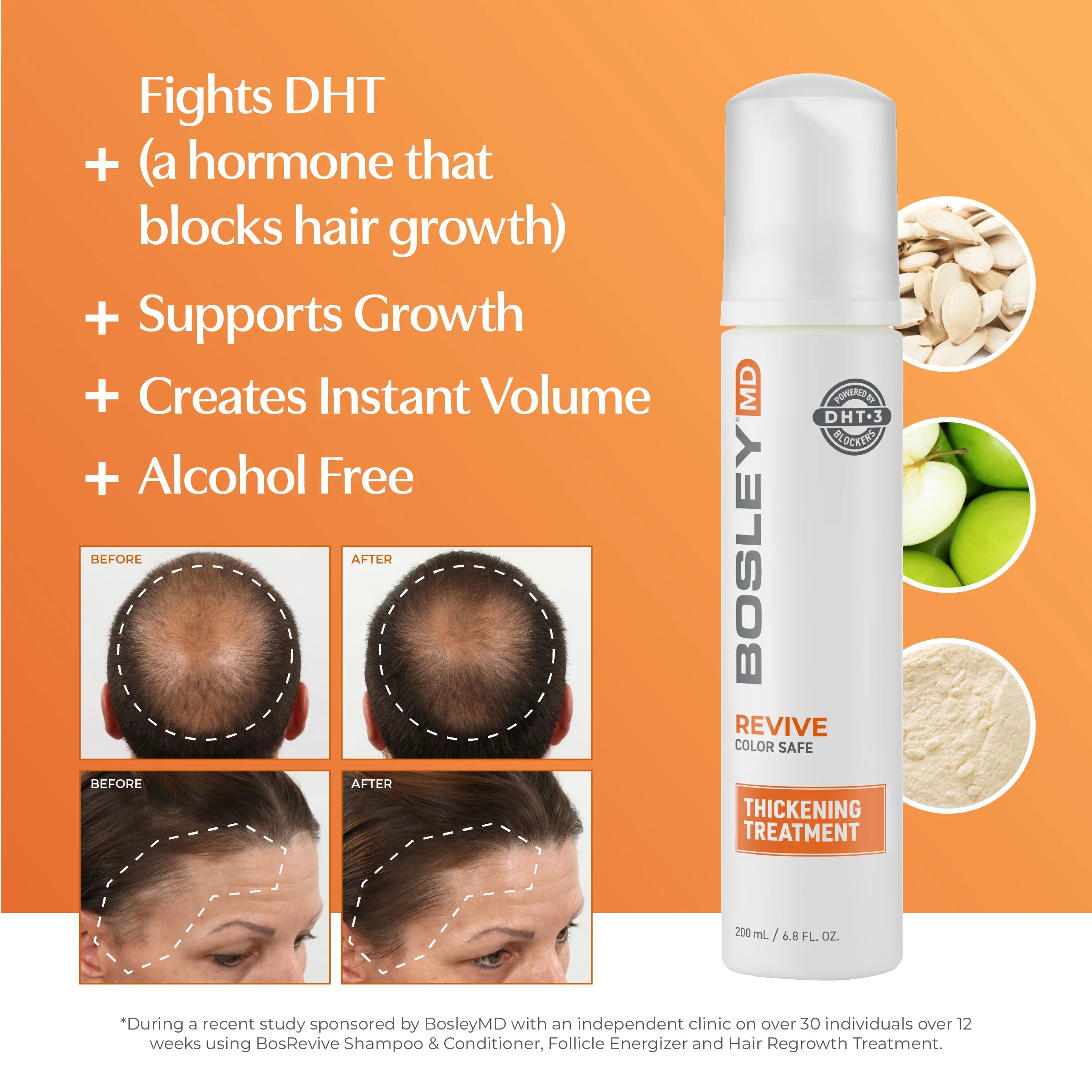 Bosley MD Color Safe Thickening Treatment, 6.8-oz Regrowth - Reverse Generation Established in 2008